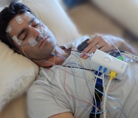 Obstructive Sleep Apnea (osa) e Polisonnografia